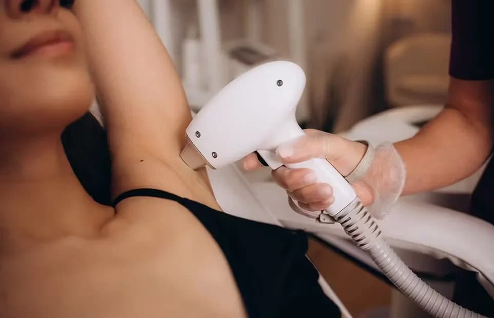 Laser Hair Removal